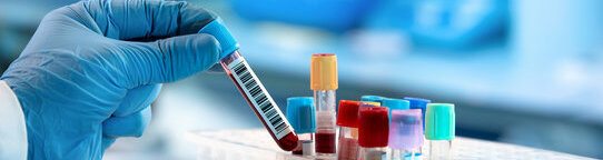 Fite Faraco Stain For Acid Fast Bacilli